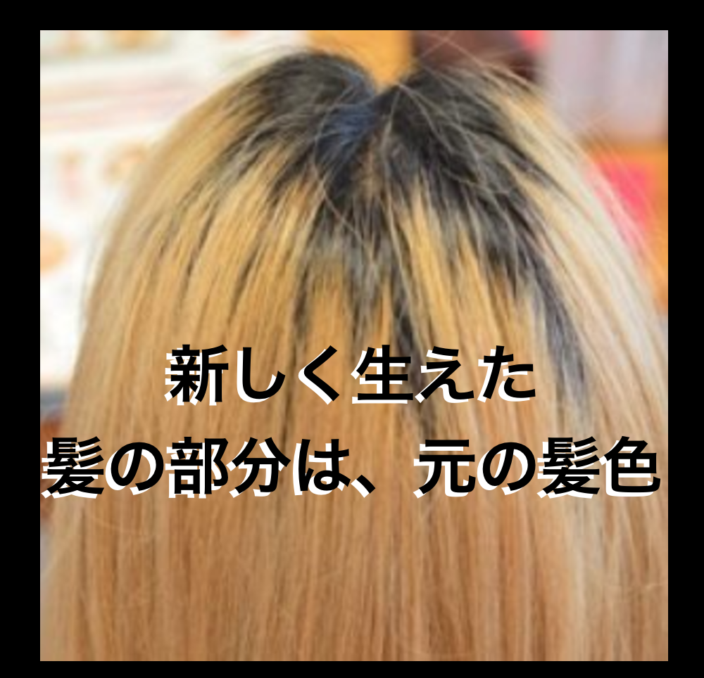 白髪の根元だけ白いのは改善できる 原因 理由と黒髪に戻す方法についても Makikoブログ